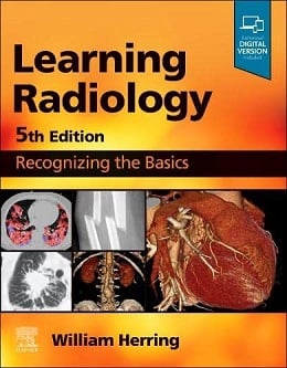 دانلود کتاب یادگیری رادیولوژی: شناخت مبانی + ویدئو Learning Radiology: Recognizing the Basics, 5ed + Video