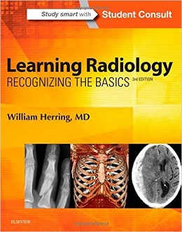 دانلود کتاب یادگیری رادیولوژی هِرینگ: شناخت مبانی Learning Radiology: Recognizing the Basics, 3ed