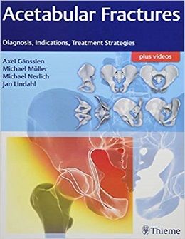 دانلود کتاب شکستگی های حفره حقه ای: تشخیص، علائم، استراتژی های درمان + ویدئو Acetabular Fractures: Diagnosis, Indications, Treatment Strategies, 1ed + Video