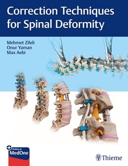 دانلود کتاب تکنیک های اصلاح ناهنجاری ستون فقرات Correction Techniques for Spinal Deformity 1st Edition