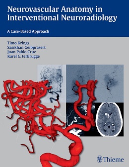 دانلود کتاب آناتومی عصبی عروقی در نورورادیولوژی مداخله ای Neurovascular Anatomy in Interventional Neuroradiology: A Case-Based Approach, 1ed